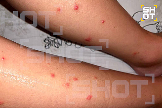 Rossijane na maldivah pozhalovalis na komarov perenosjashhih opasnyj virus 4a89ce0.jpg